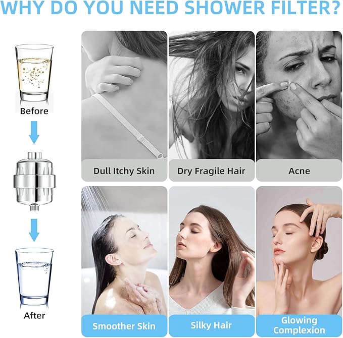 24 Stage Shower Water Filter - High Output Softener to Remove Chlorine and Fluoride - Reduces Dry Itchy Skin, Dandruff, and Improves The Condition of Your Skin, Hair, Chrome